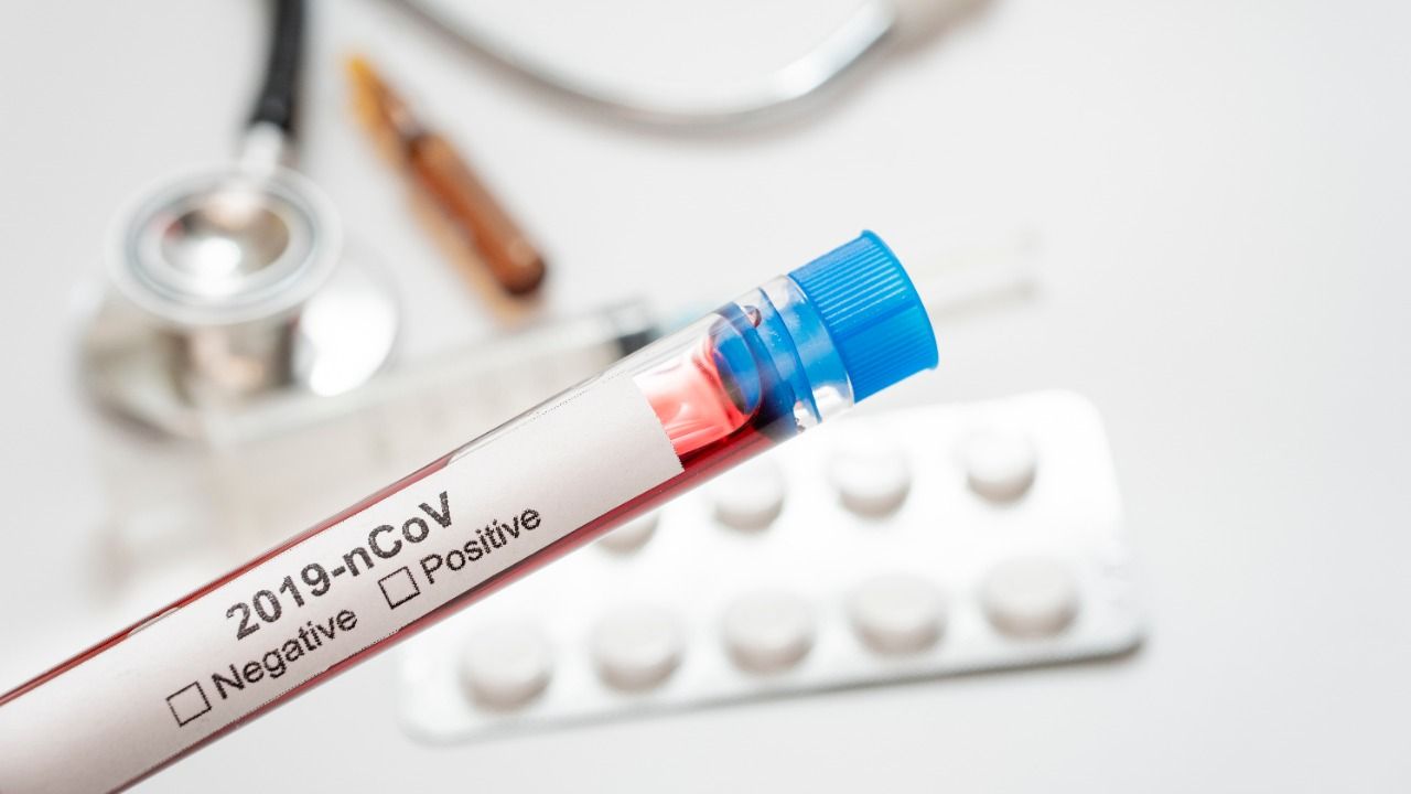 Algunos aspectos sobre el COVID-19